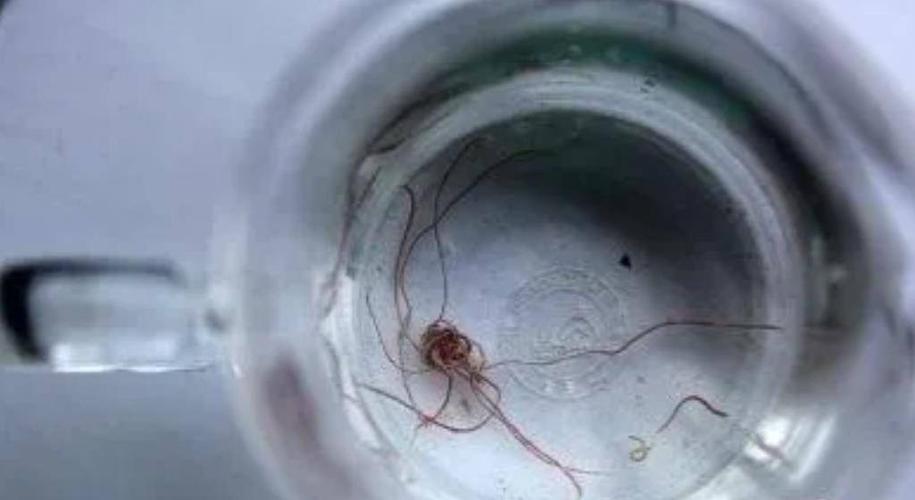 自来水中含活体虫,自来水中含活体虫吗